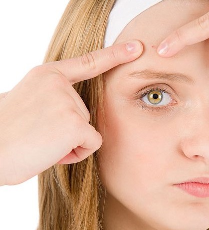 O que fazer para tratar a acne ?